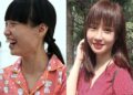 5 ca phẫu thuật khó tại bệnh viện thẩm mỹ Kangnam